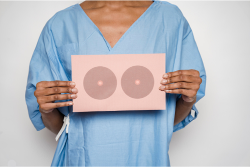 New study: Double mastectomy doesn't improve breast cancer survival